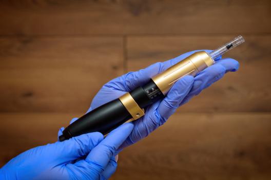 Aumento delle labbra senza ago con una Hyaluron Pen