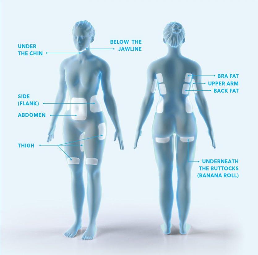 Confronta i prezzi del CoolSculpting