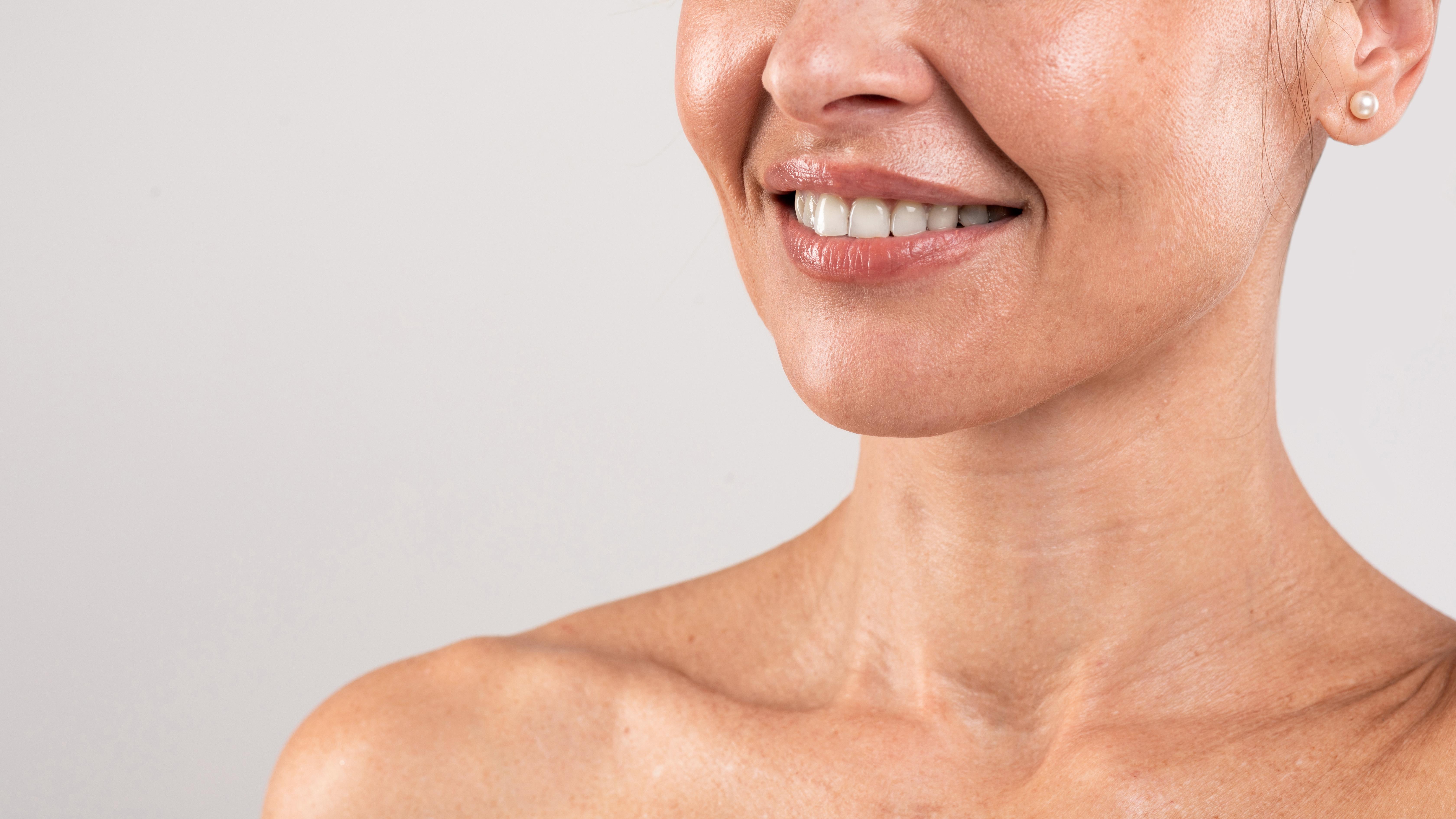 Botox per il mento: ridurre effetto buccia d’arancia e fossette