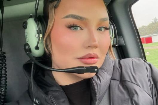 Heeft Nikkie de Jager botox?
