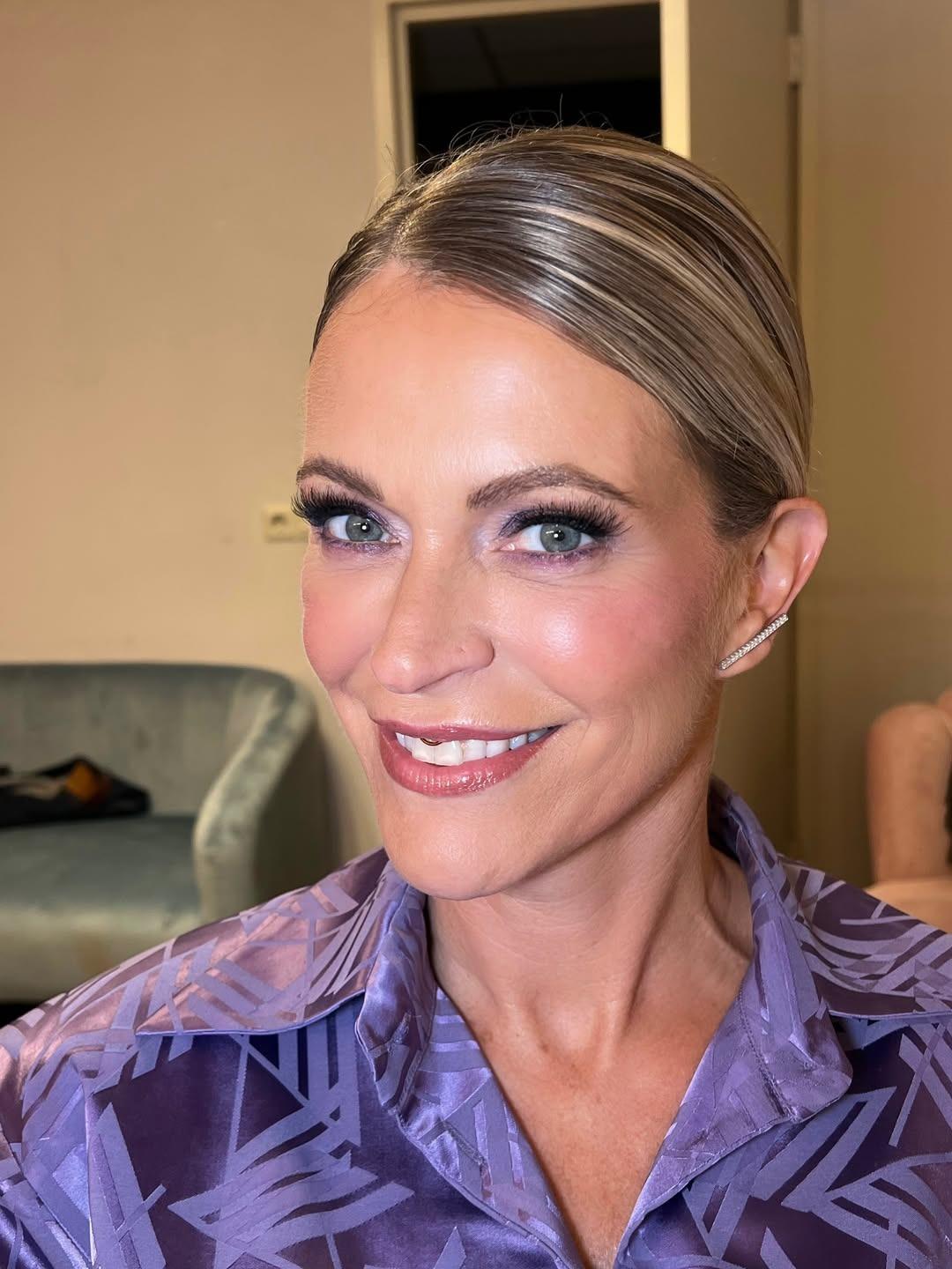 Heeft Karen Damen botox?