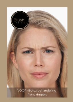 Photo Rides du lion de Blush Clinics Oss (avant)