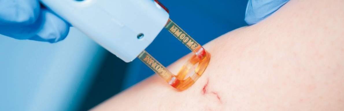 Injektionsbehandlung gegen Falten in Mölln bei Dr. med. Marc Hanno Segert Facharzt für Dermatologie