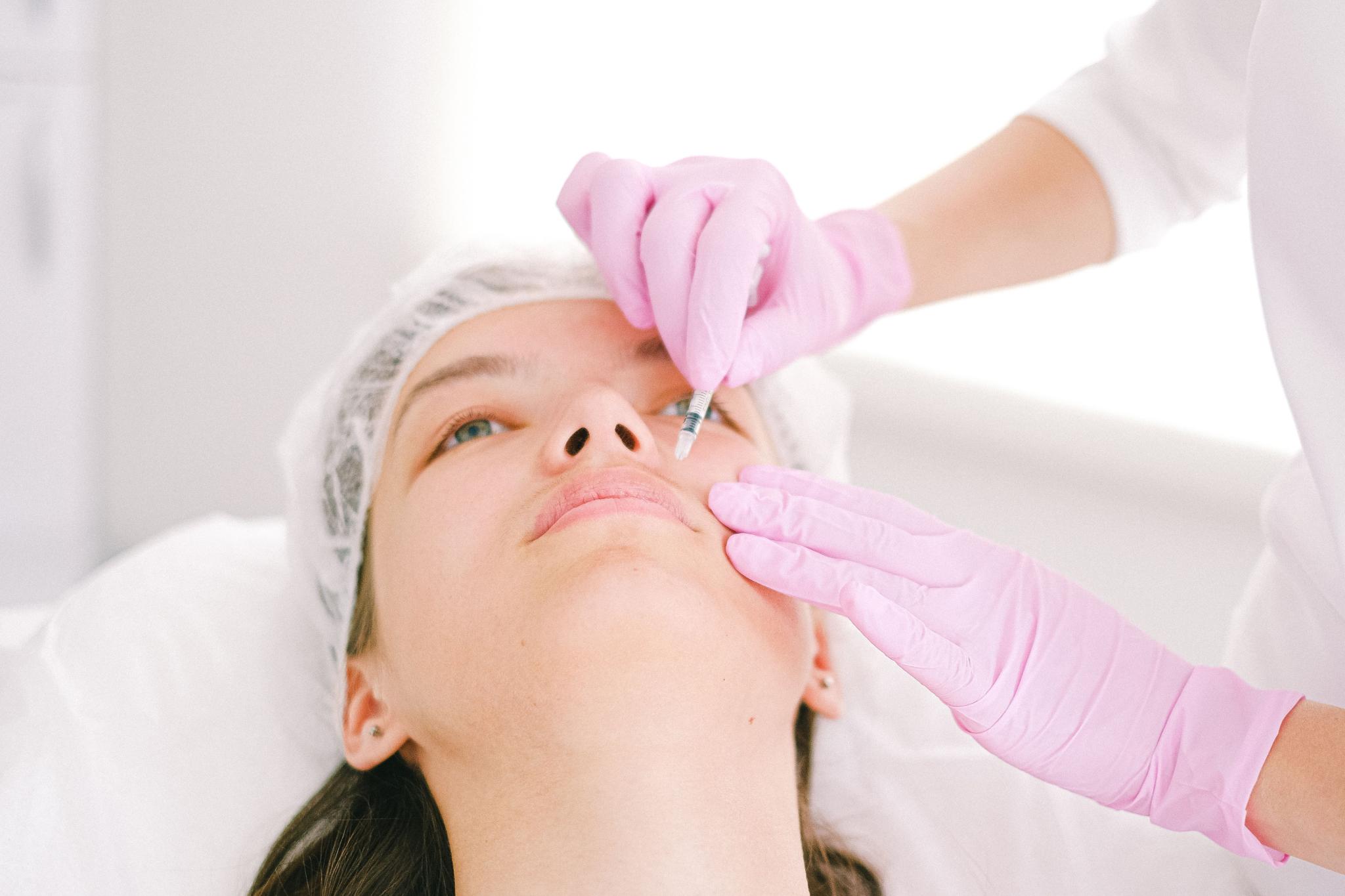 Fillers before and after