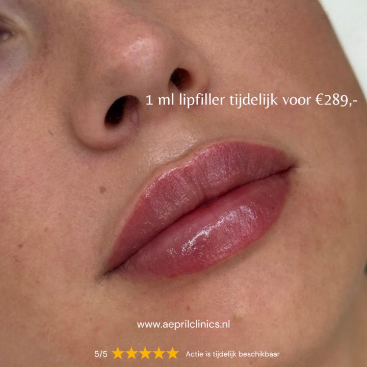 Zomerdeals bij Aepril Clinics - t/m €100,- korting!