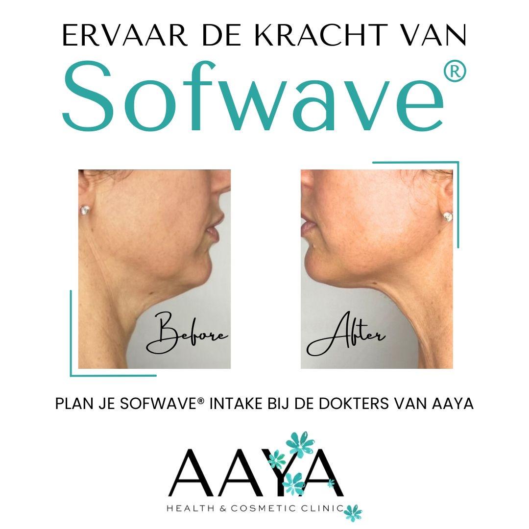 Injectables behandeling voor rimpels in Amsterdam bij AAYA Health & Cosmetic Clinics