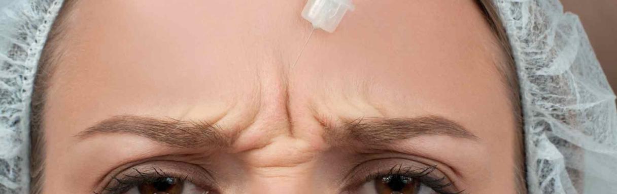 Injektionsbehandlung gegen Falten in Lübbecke bei HNO-PRAXISKLINIK LÜBBECKE | Dr. Jürgen Blaue & Dr. Christopher Klein