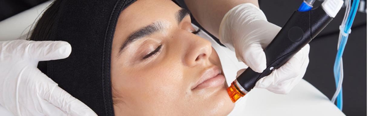Injectables treatment for wrinkles in Seaford at Ageless by Nikki ltd