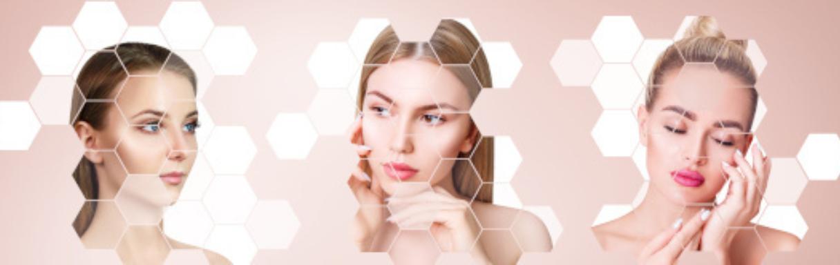 Injektionsbehandlung gegen Falten in Koblenz bei Nicole Heider- Fachärztin für Dermatologie Ästhetische Medizin
