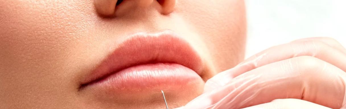 Injectables treatment for wrinkles in Luton at Wigmore Aesthetics