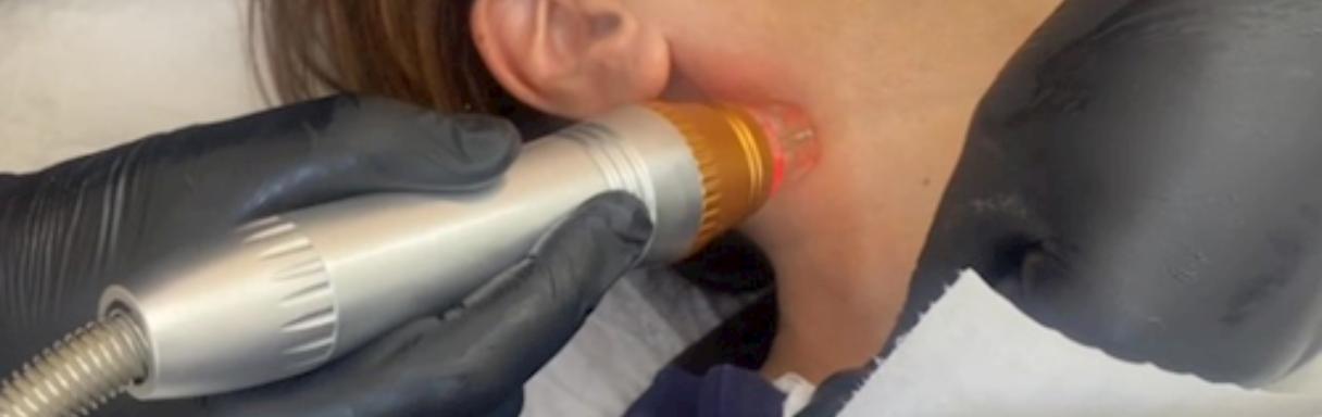 Injectables treatment for wrinkles in Liverpool at Woodlands Aesthetic & Beauty Clinic