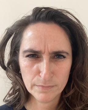 Botox foto van Kliniek Zuyd (voor)