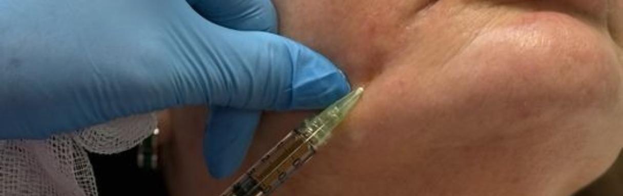 Injectables treatment for wrinkles in Newport at Timeless Aesthetics Clinic