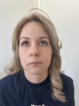 Lipfillers foto van Kliniek Zuyd (voor)