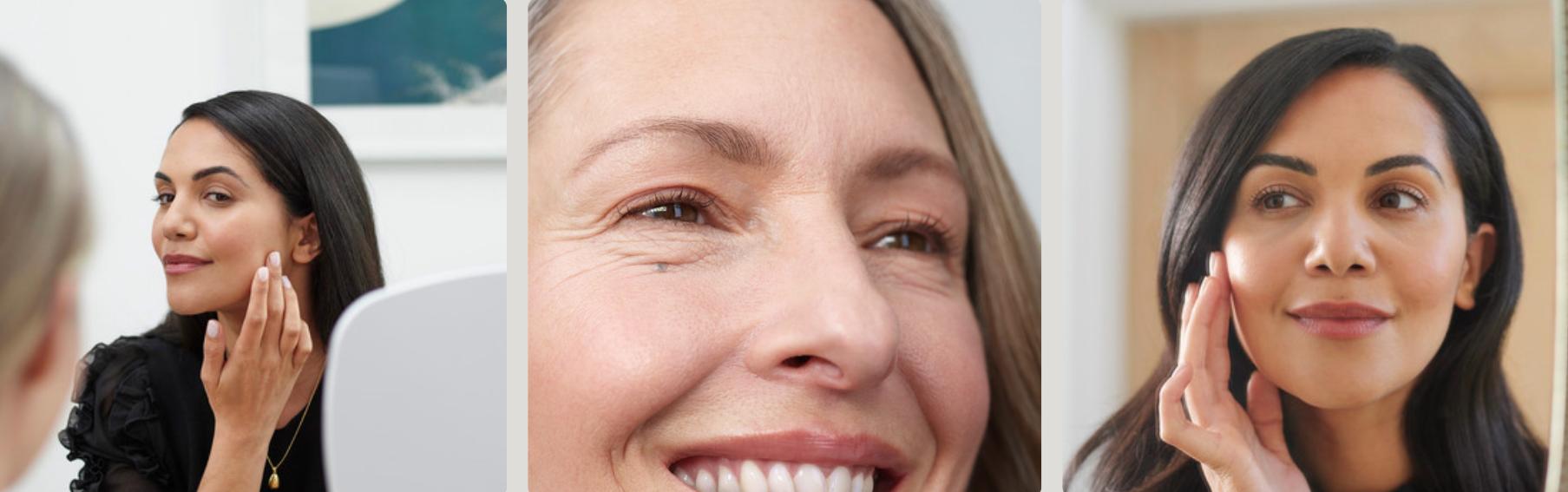 Injectables behandeling voor rimpels in Amsterdam bij DNA Clinics Amsterdam