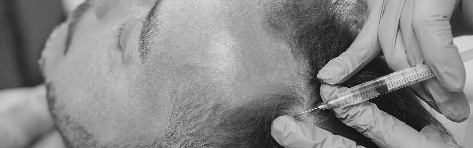 Injectables treatment for wrinkles in Nottingham at White Orchid Dental & Wellbeing Clinic