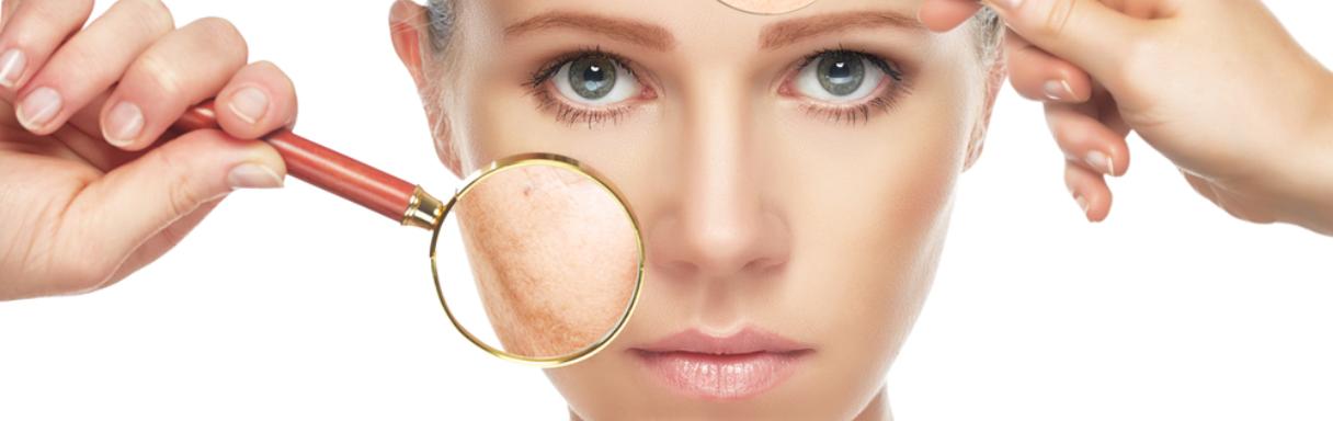 Injectables treatment for wrinkles in Lincoln at Lincoln Laser Skincare