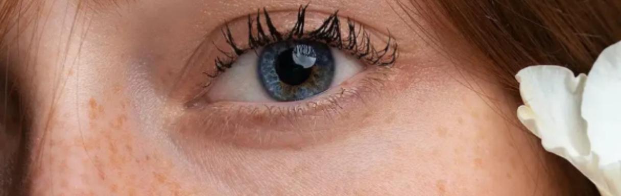 Injectables treatment for wrinkles in Kingston upon Thames at It's Me and You Clinic - Anti-Wrinkle, Dermal Filler and Skincare Clinic, Kingston, Surrey