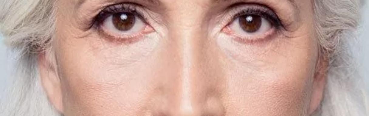 Injectables treatment for wrinkles in Brighton at Plasmapod skin clinic