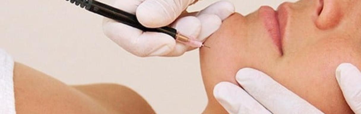 Injectables treatment for wrinkles in Dubai at Sultan Al Olama Medical