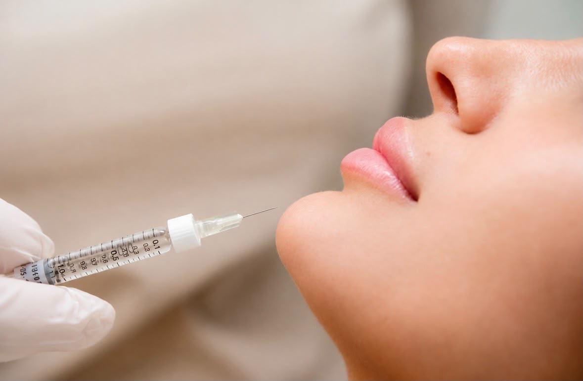 Injectables behandeling voor rimpels in Dordrecht bij FillerHouse
