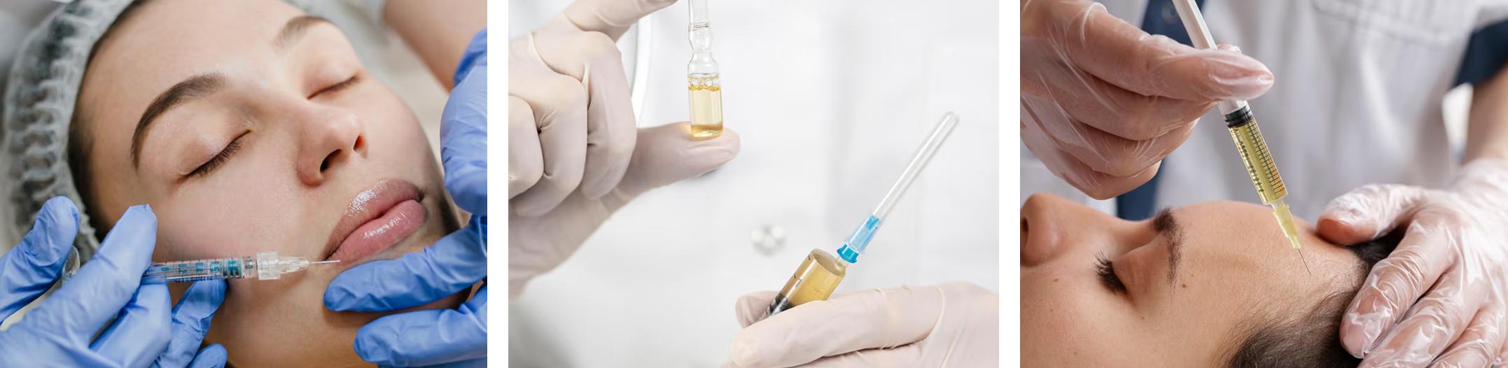 Injectables behandeling voor rimpels in Hulshout bij Cosmedics Hulshout