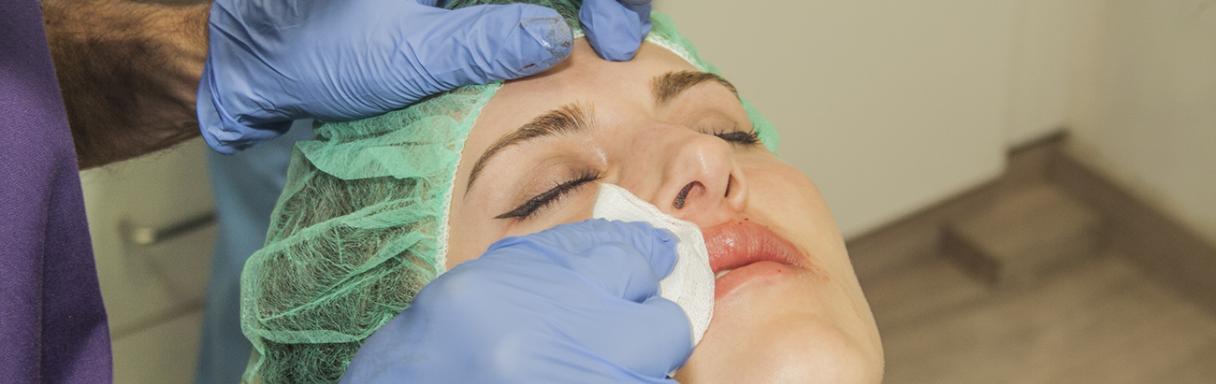 Tratamiento de inyectables para arrugas en Tarragona en Dr Mario Mateos. Medicina Estetica Facial.Tarragona