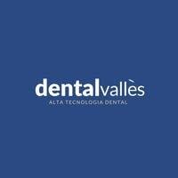 Dental Vallès / Implantes, Ortodoncia Invisible, Estética, urgencias