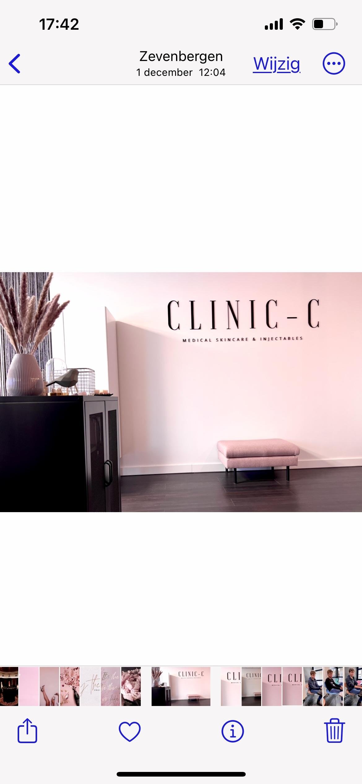 Injectables behandeling voor rimpels in Zevenbergen bij Clinic C Zevenbergen