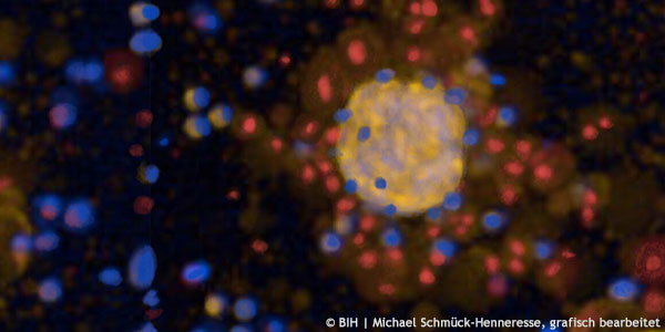 Gentechnisch veränderte Immunzellen (CAR-T-Zellen, blau) greifen dreidimensionales Tumorgewebe (Tumoroide, gelb) gezielt an und töten Tumorzellen ab (sichtbar an rot markierten abgestorbenen Zellen).