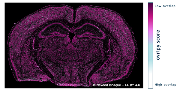 Helle Punkte und Regionen deuten auf zelluläre Überlappungen hin in diesem mit ovrlpy analysierten Koronalschnitt eines Mausgehirns.