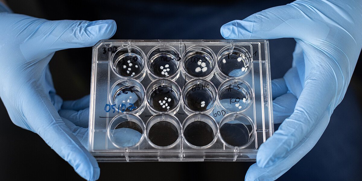 Brain organoids, 30 and 60 days-old in a Petri dish