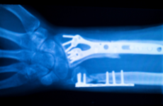 Oberarzt (m/w/d) Orthopädie und Unfallchirurgie