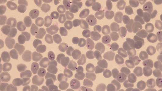Red blood cells infected with P. falciparum (Photo: A. Passecker, Swiss TPH)