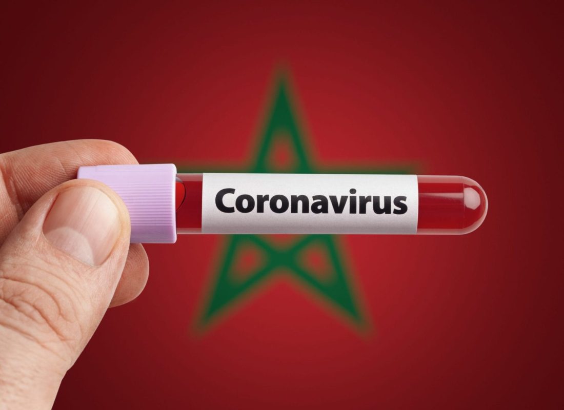 Mise en place d’un dispositif d’indemnisation des effets secondaires du vaccin Covid-19