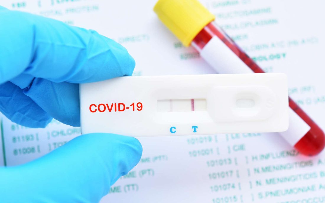 Covid 19 : cinq ans après, quels sont les enseignements ?