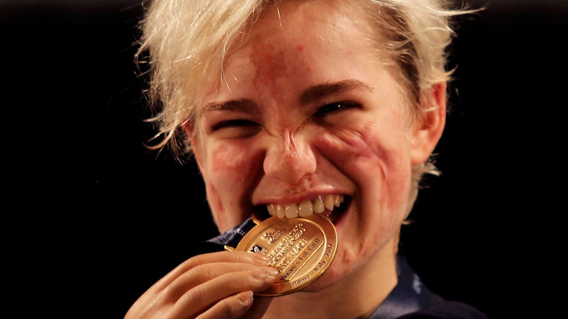 Lasciare un’impronta – Beatrice Vio