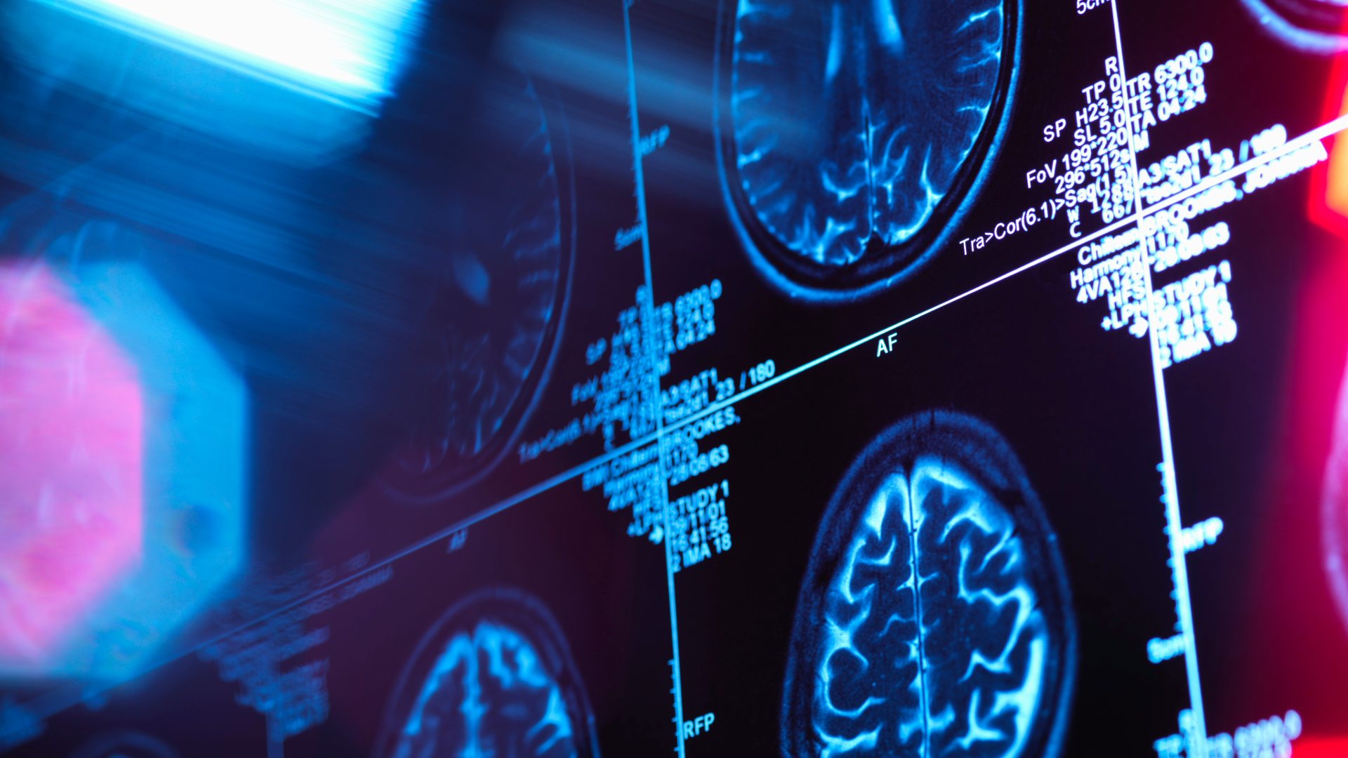 Dentro il cervello: percezione