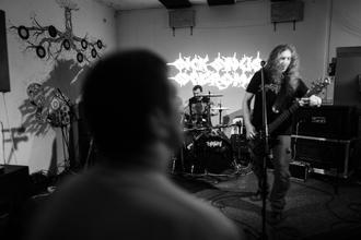 Sick Synus Syndrome (3)