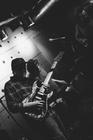 TheBladderStones4