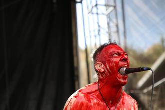 005 Haemorrhage