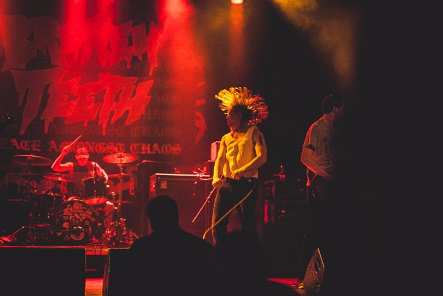 broken teeth-2353 (1)