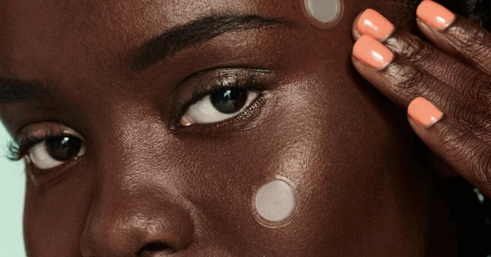 Pimple patches via MEFeater.com