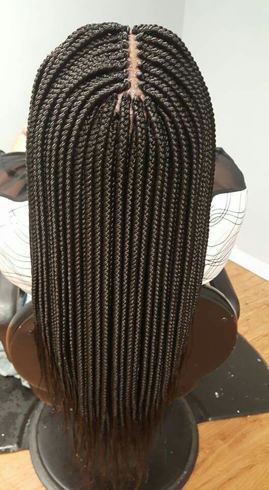 High-tension hairstyles: Excessively tight box braids 