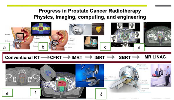 Three-dimensional conformal radiotherapy