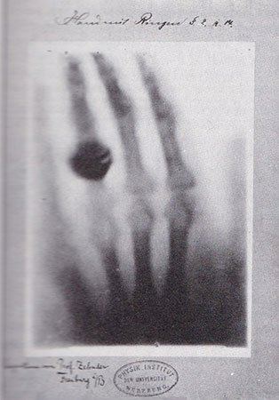 One of the first radiographs