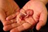 photo-2-Rituel pour avorter une grossesse, rituel pour provoquer une fausse couche
