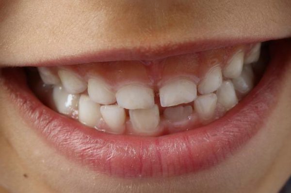 One In Six People Waiting Over Three Months For Dental Appointment - Vimarsana News