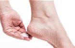 Cracked Heels 101: Causes, Symptoms and Treatment