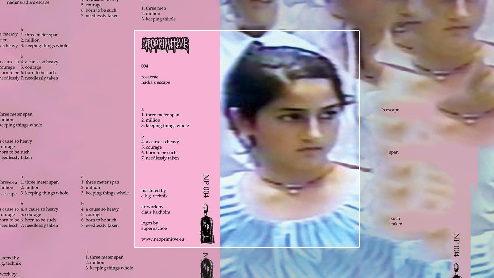 RT-Rosacaea